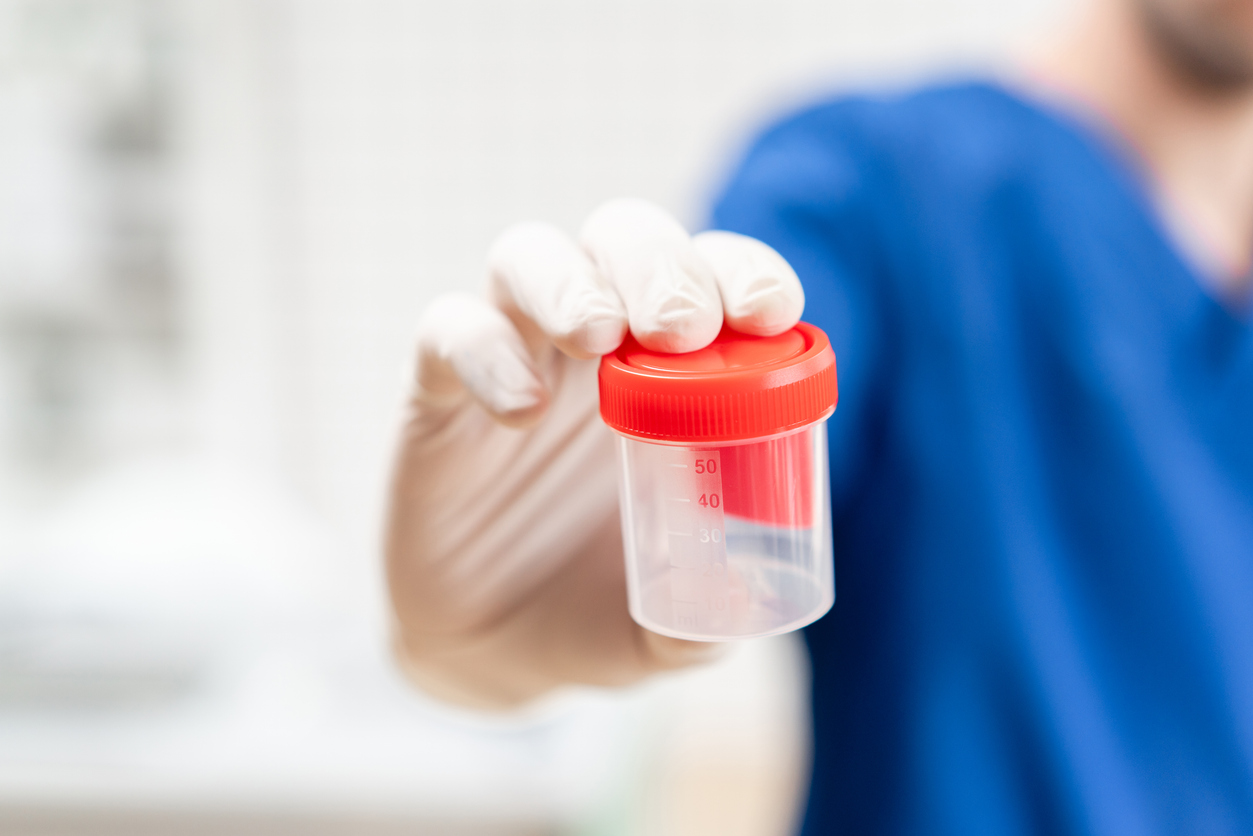 Why Drug Testing is Essential for Workplace Safety